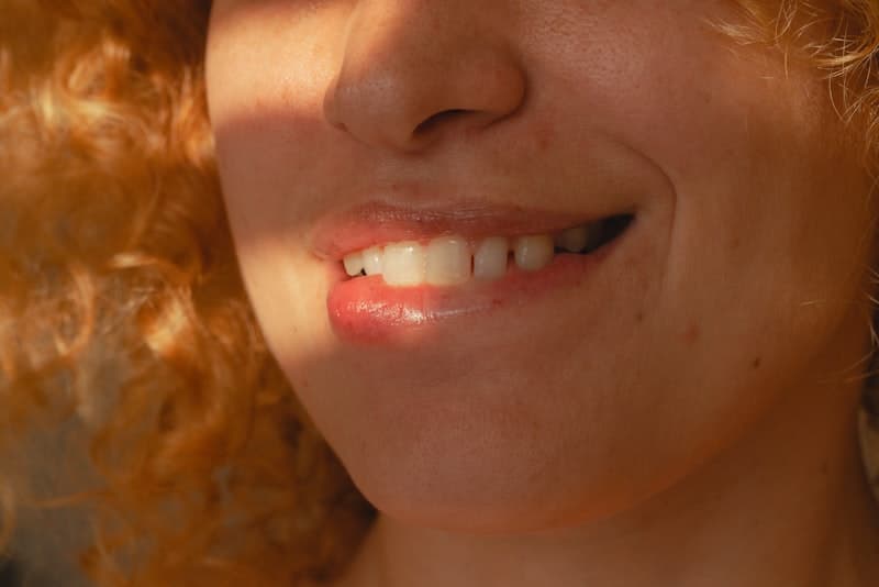 Professional teeth whitening results at Buchwald Family Dentistry in Richardson, TX